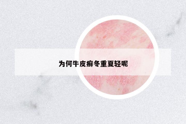 為何牛皮癬冬重夏輕呢