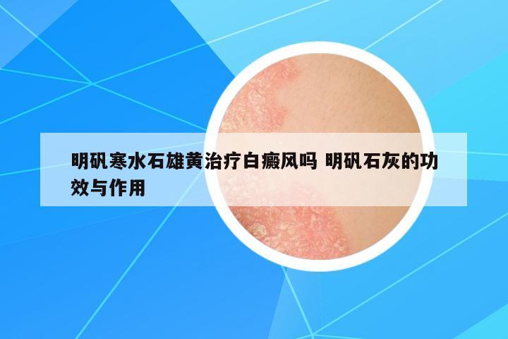 明礬寒水石雄黃治療白癜風(fēng)嗎 明礬石灰的功效與作用