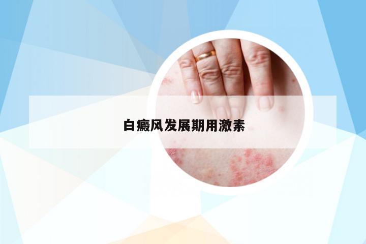 白癜風(fēng)發(fā)展期用激素