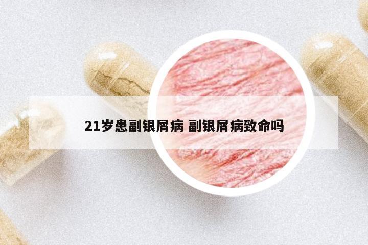 21歲患副銀屑病 副銀屑病致命嗎