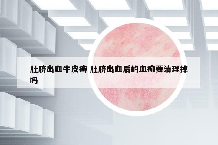 肚臍出血牛皮癬 肚臍出血后的血痂要清理掉嗎