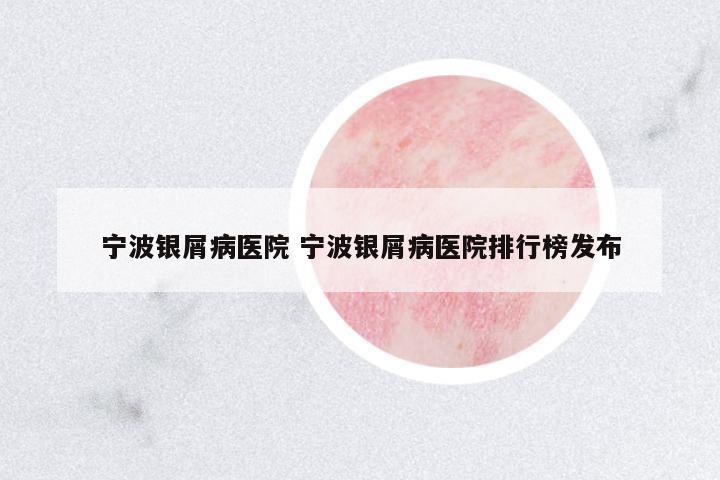 寧波銀屑病醫(yī)院 寧波銀屑病醫(yī)院排行榜發(fā)布