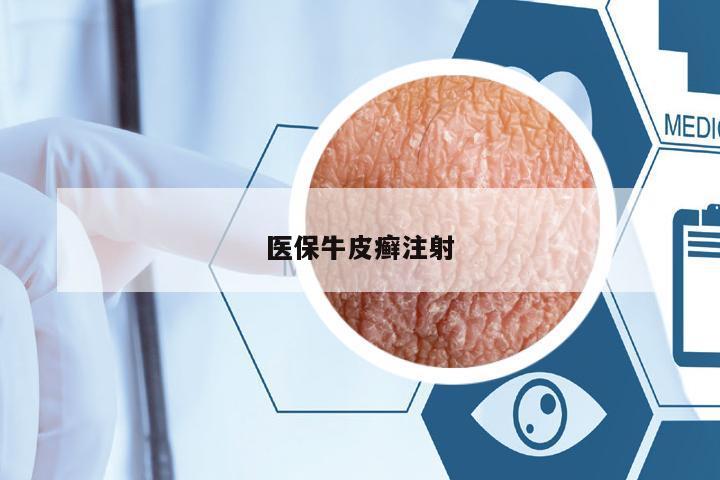 醫(yī)保牛皮癬注射