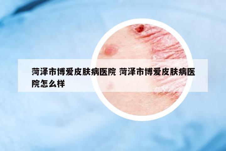 菏澤市博愛皮膚病醫(yī)院 菏澤市博愛皮膚病醫(yī)院怎么樣