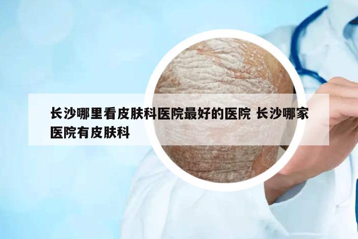 長沙哪里看皮膚科醫(yī)院最好的醫(yī)院 長沙哪家醫(yī)院有皮膚科
