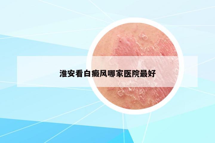 淮安看白癜風(fēng)哪家醫(yī)院最好