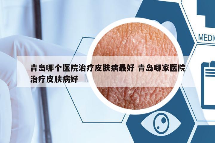 青島哪個(gè)醫(yī)院治療皮膚病最好 青島哪家醫(yī)院治療皮膚病好