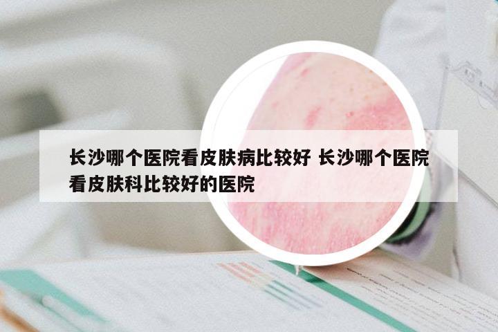 長沙哪個(gè)醫(yī)院看皮膚病比較好 長沙哪個(gè)醫(yī)院看皮膚科比較好的醫(yī)院