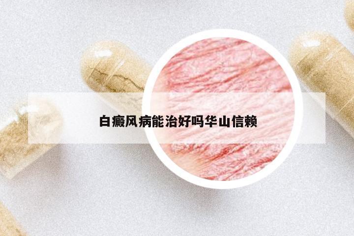 白癜風(fēng)病能治好嗎華山信賴