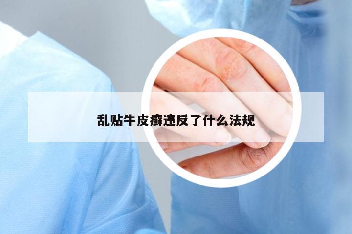 亂貼牛皮癬違反了什么法規(guī)