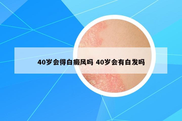 40歲會(huì)得白癜風(fēng)嗎 40歲會(huì)有白發(fā)嗎