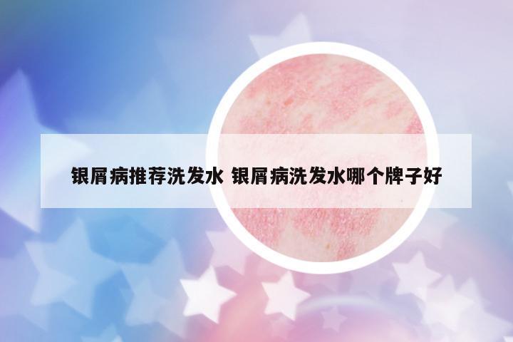 銀屑病推薦洗發(fā)水 銀屑病洗發(fā)水哪個牌子好