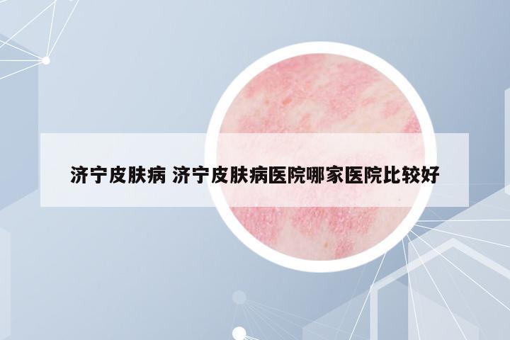 濟(jì)寧皮膚病 濟(jì)寧皮膚病醫(yī)院哪家醫(yī)院比較好
