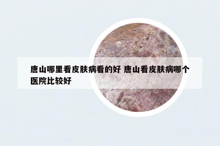唐山哪里看皮膚病看的好 唐山看皮膚病哪個(gè)醫(yī)院比較好