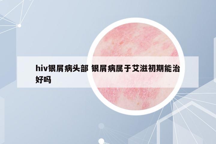 hiv銀屑病頭部 銀屑病屬于艾滋初期能治好嗎