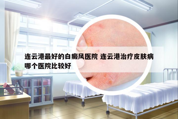 連云港最好的白癜風(fēng)醫(yī)院 連云港治療皮膚病哪個醫(yī)院比較好