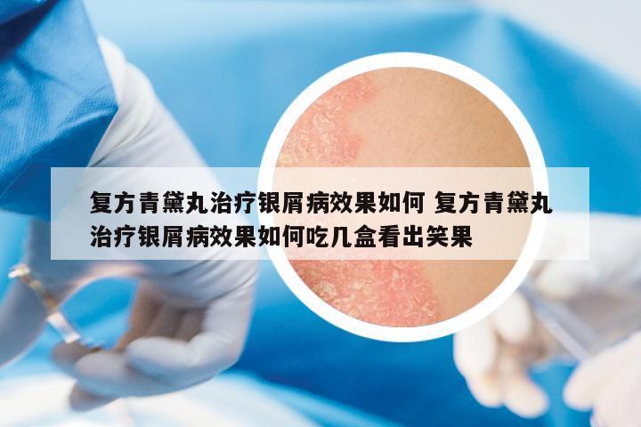 復(fù)方青黛丸治療銀屑病效果如何 復(fù)方青黛丸治療銀屑病效果如何吃幾盒看出笑果