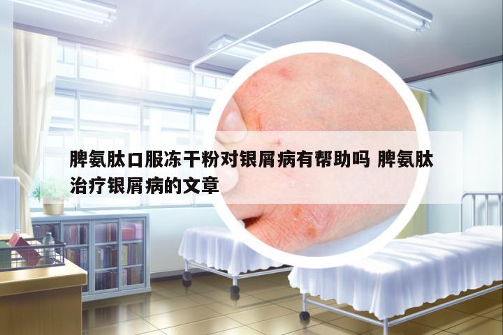 脾氨肽口服凍干粉對銀屑病有幫助嗎 脾氨肽治療銀屑病的文章