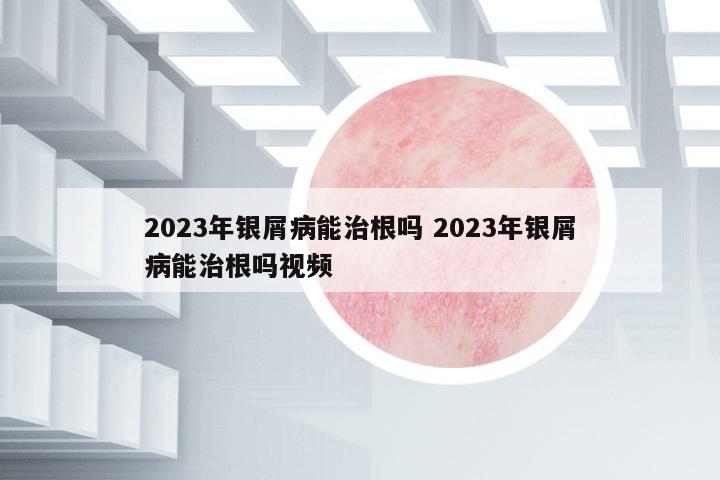 2023年銀屑病能治根嗎 2023年銀屑病能治根嗎視頻