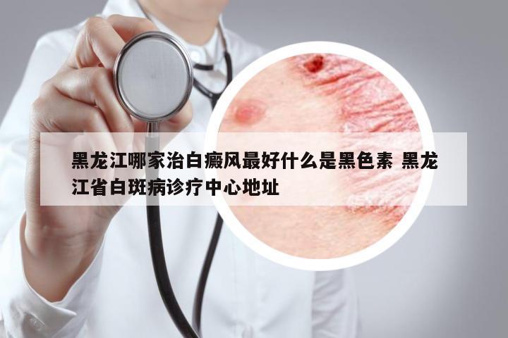 黑龍江哪家治白癜風(fēng)最好什么是黑色素 黑龍江省白斑病診療中心地址