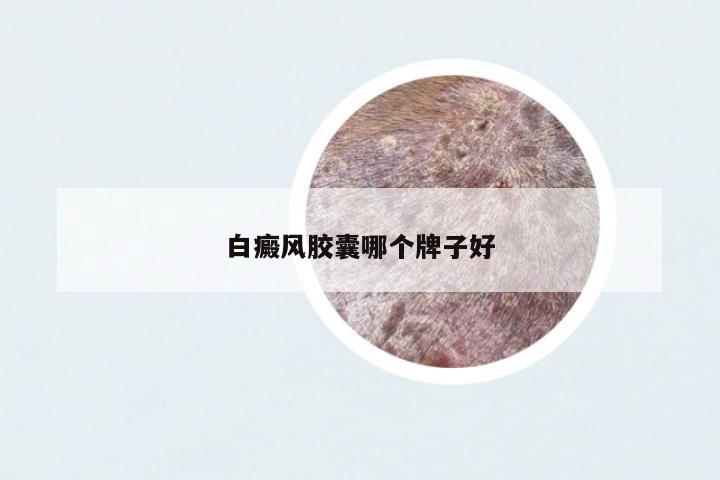 白癜風膠囊哪個牌子好