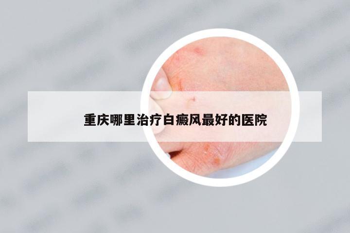 重慶哪里治療白癜風(fēng)最好的醫(yī)院
