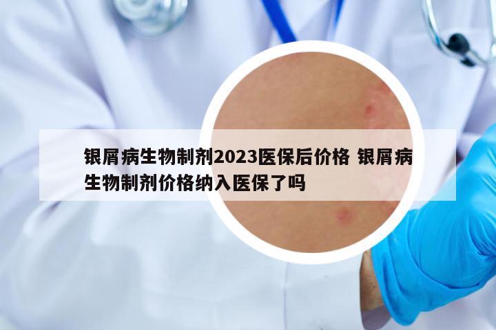 銀屑病生物制劑2023醫(yī)保后價格 銀屑病生物制劑價格納入醫(yī)保了嗎