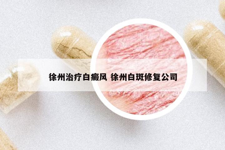徐州治療白癜風(fēng) 徐州白斑修復(fù)公司