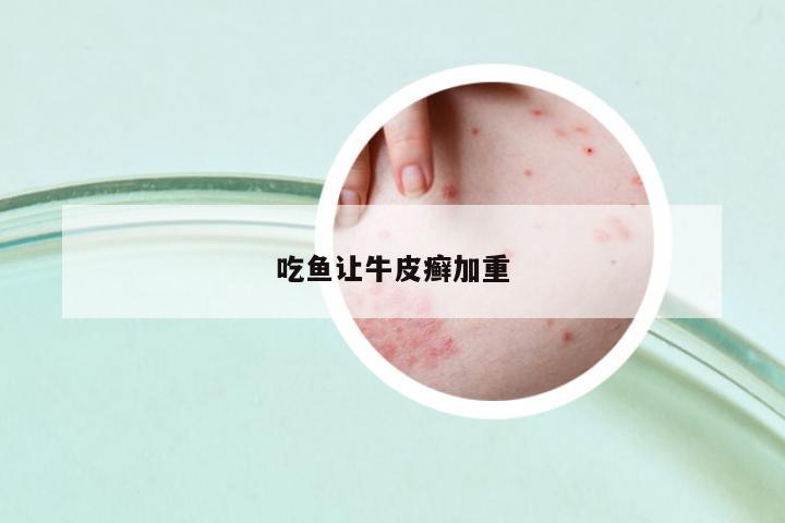 吃魚讓牛皮癬加重