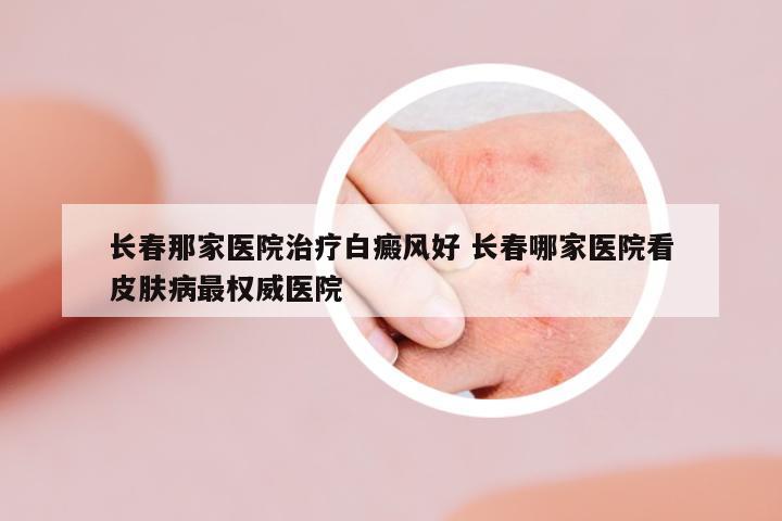 長春那家醫(yī)院治療白癜風(fēng)好 長春哪家醫(yī)院看皮膚病最權(quán)威醫(yī)院
