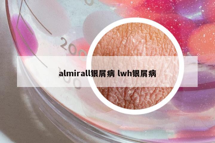 almirall銀屑病 lwh銀屑病