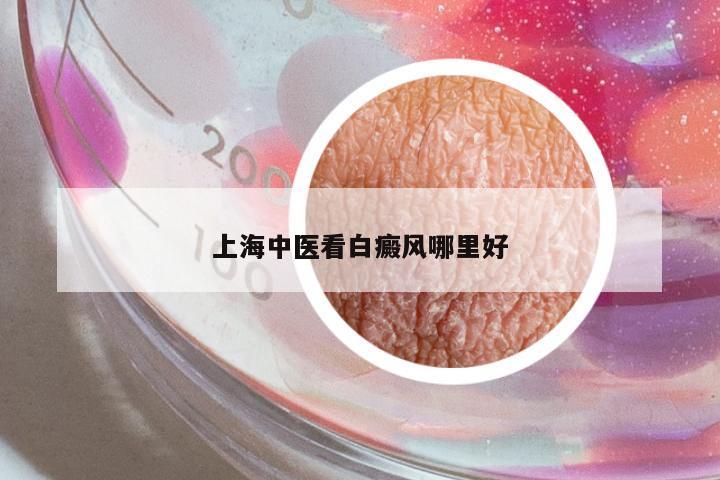 上海中醫(yī)看白癜風哪里好