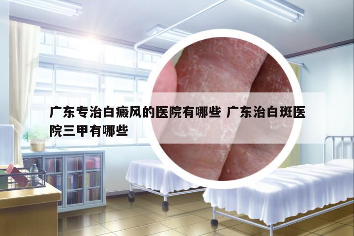 廣東專治白癜風(fēng)的醫(yī)院有哪些 廣東治白斑醫(yī)院三甲有哪些