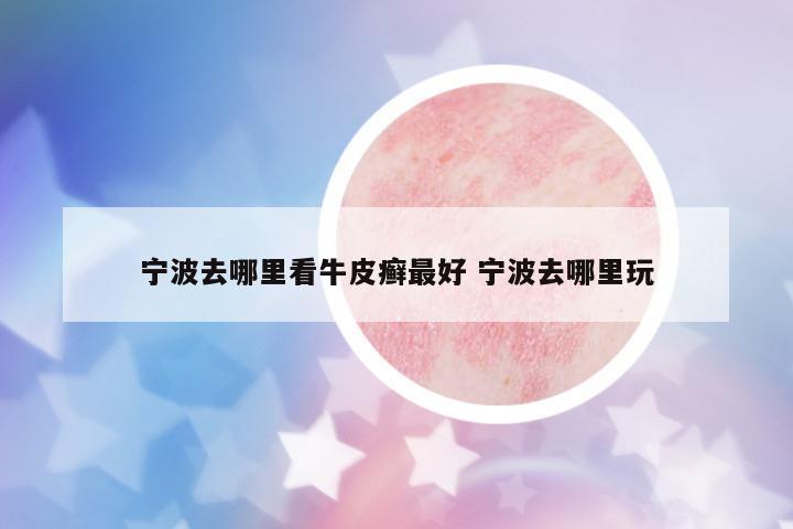 寧波去哪里看牛皮癬最好 寧波去哪里玩