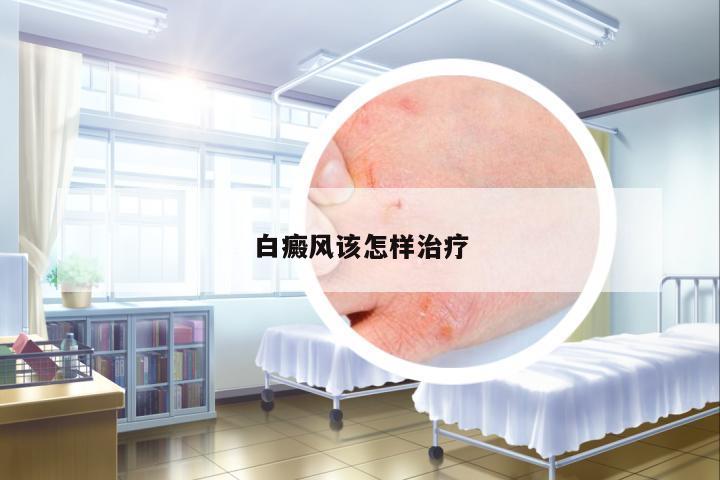 白癜風(fēng)該怎樣治療