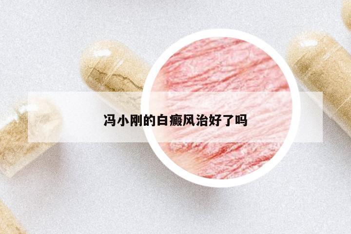 馮小剛的白癜風(fēng)治好了嗎