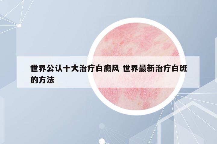 世界公認(rèn)十大治療白癜風(fēng) 世界最新治療白斑的方法