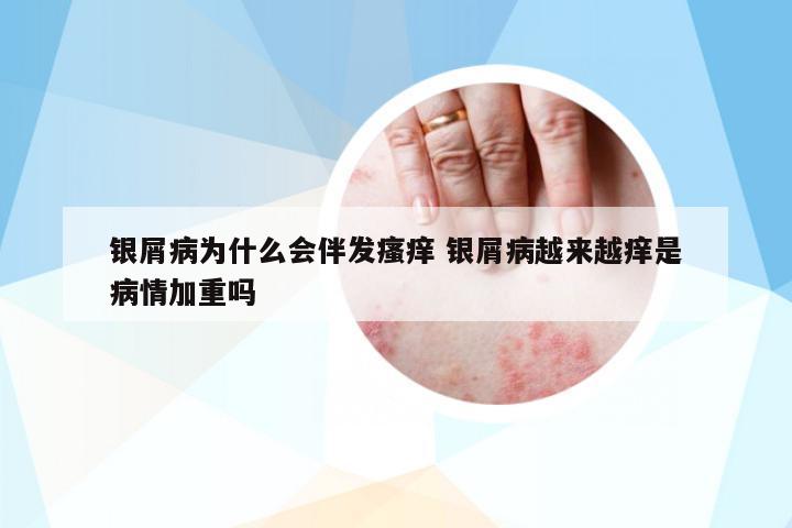 銀屑病為什么會(huì)伴發(fā)瘙癢 銀屑病越來(lái)越癢是病情加重嗎
