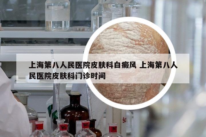 上海第八人民醫(yī)院皮膚科白癜風(fēng) 上海第八人民醫(yī)院皮膚科門診時間