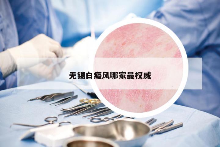 無錫白癜風(fēng)哪家最權(quán)威
