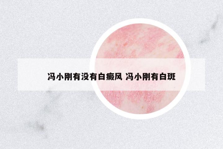 馮小剛有沒有白癜風(fēng) 馮小剛有白斑