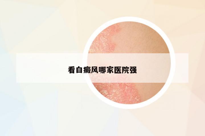 看白癜風哪家醫(yī)院強