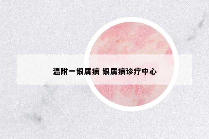 溫附一銀屑病 銀屑病診療中心