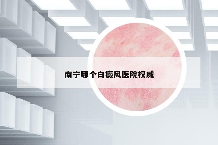 南寧哪個(gè)白癜風(fēng)醫(yī)院權(quán)威