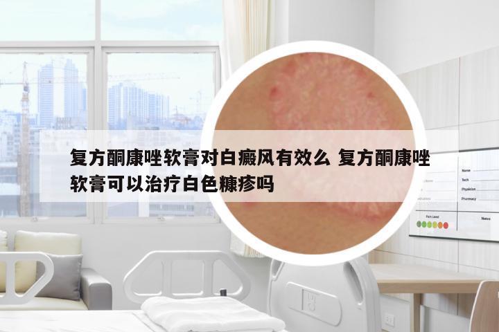 復(fù)方酮康唑軟膏對白癜風(fēng)有效么 復(fù)方酮康唑軟膏可以治療白色糠疹嗎