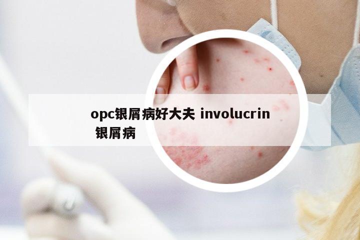 opc銀屑病好大夫 involucrin 銀屑病