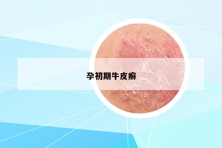 孕初期牛皮癬