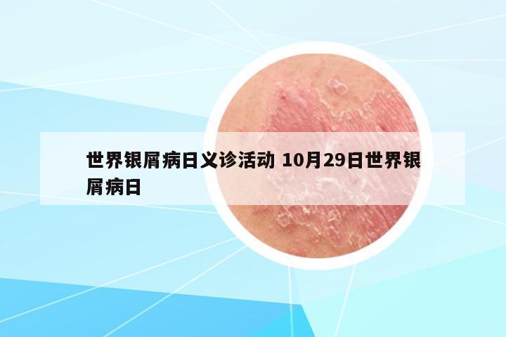世界銀屑病日義診活動(dòng) 10月29日世界銀屑病日
