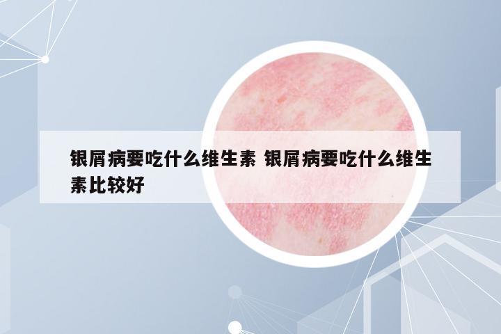 銀屑病要吃什么維生素 銀屑病要吃什么維生素比較好