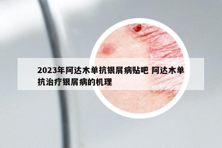2023年阿達(dá)木單抗銀屑病貼吧 阿達(dá)木單抗治療銀屑病的機(jī)理